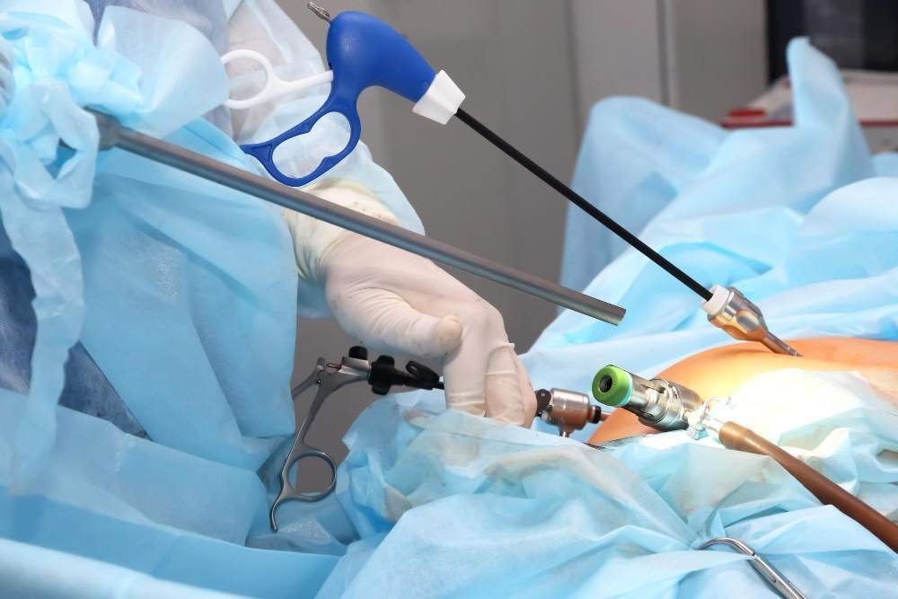 Laparoscopic Ovarian Cystectomy