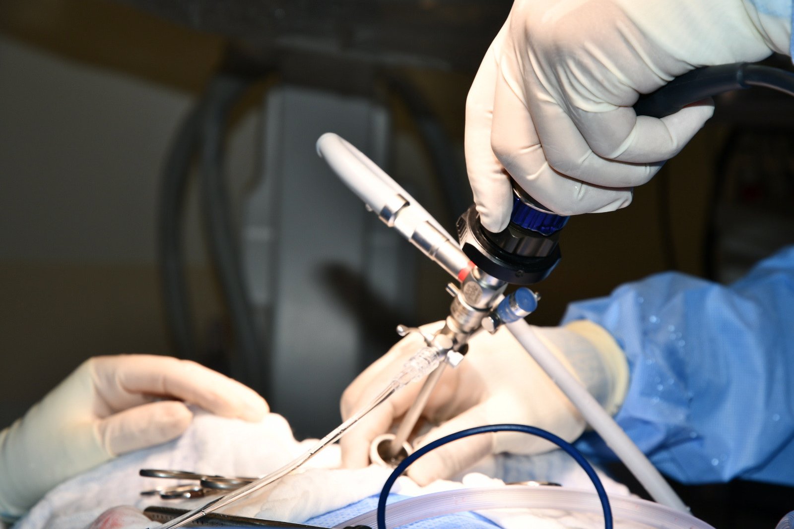 Optical Cystolithotomy